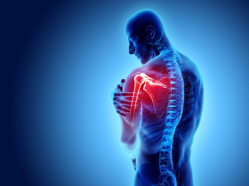 Joint Health & Arthritis – Natural Relief with Homeopathic Treatment