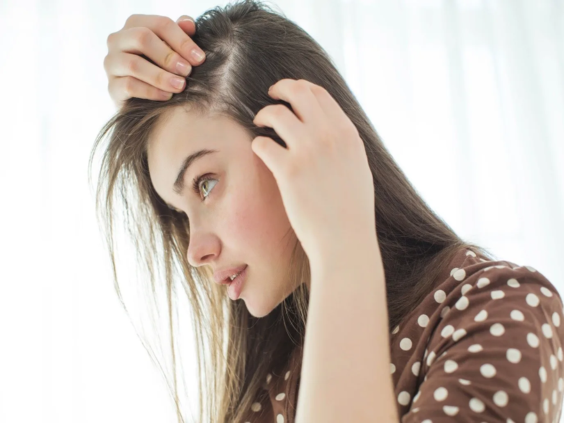 Hair Fall Treatment with Homeopathy, A Natural Way to Restore Healthy Hair