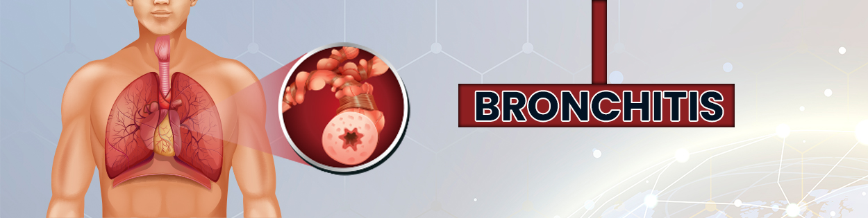 chronic bronchitis treatment