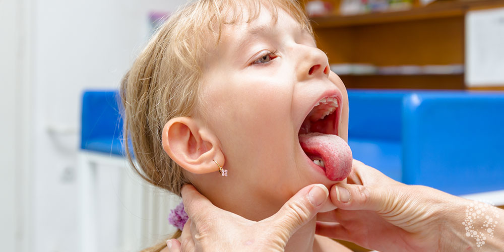 chronic tonsilitis treatment